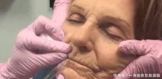 爱美之心|80岁奶奶打玻尿酸,仿佛年轻了40岁:老了也要美美的