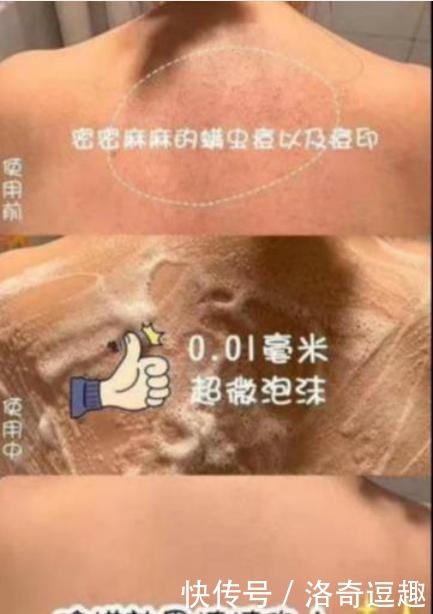 肌肤|国内有款“不起眼”洁面皂,因价低受冷落,却能抑菌除螨消痘