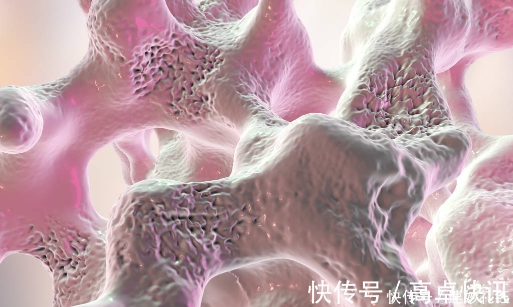 菠菜|骨科医生:人过60,就怕骨折!吃什么能护骨?不喜欢也要多吃