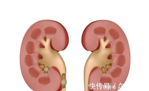 肾功能|尿毒症早期向你发出的警告, 你一定想不到!