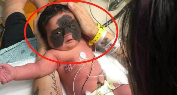 泪目|女子生下“蝙蝠侠”,亲戚朋友不敢靠近,父母的举动却让人泪目