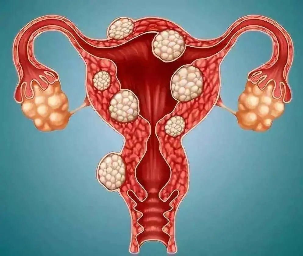 妇科|5分钟教你看懂妇科体检报告单!有些病可能是唬人的“纸老虎”!