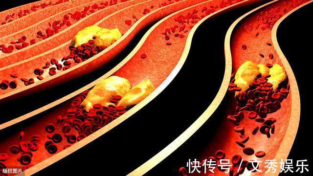 高血糖|血糖高不高，看脸就知道！若面部没4种表现，血糖还算稳定，恭喜