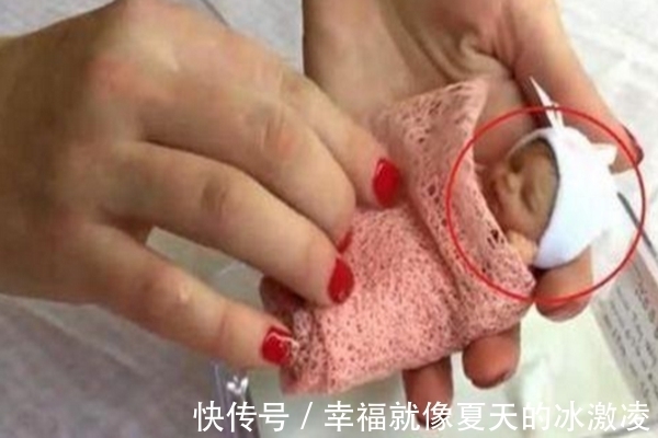 体重|18年前那个只有25厘米,体重才半斤的女孩,如今怎样了