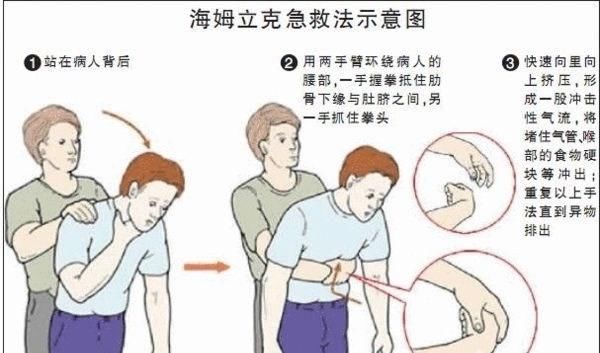 一命|“去医院就晚了!”11岁儿子被卡喉,宝妈2个“果断”救孩子一命