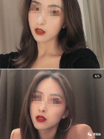 咬肌肥大，一张国字脸，小姐姐用了它，方形脸变成了巴掌脸