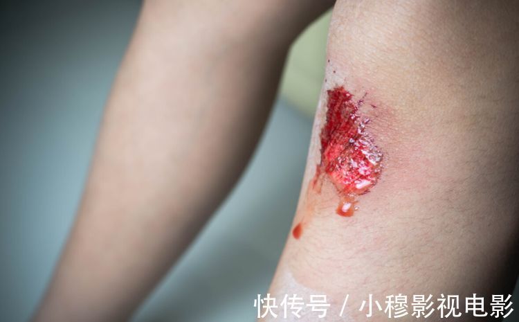 肝臟|56歲大媽肝癌離世，醫生：這3物長時間不洗，一家人的肝都遭殃