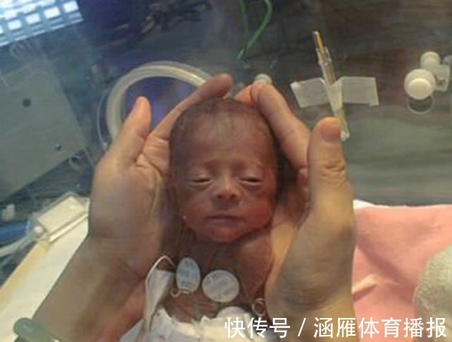 护士|孩子刚出生就“死亡”,妈妈接受不了,随后的动作挽救了孩子