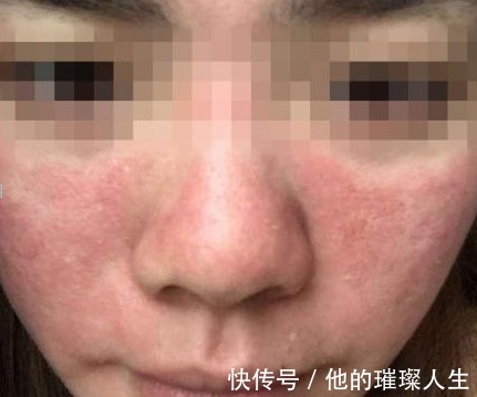 面霜 这几款爆款护肤品入手后很后悔!不仅浪费钱还可能烂脸,你们用过吗!