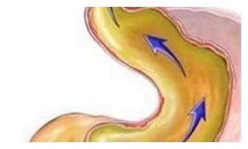 强身健体|入睡难是肝郁结，睡不好是心火旺，常喝“一碗汤”，失眠自己好