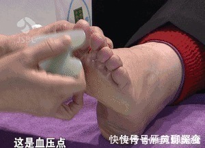 大脚趾|长期高血压,这个地方就长茧!每天刮5分钟,血压奇迹般降下来!