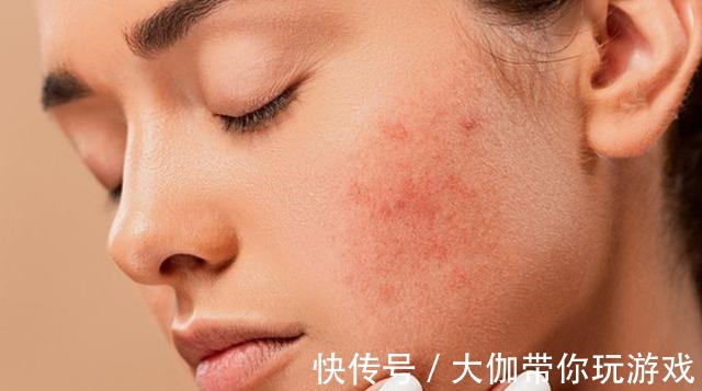 紫外线 换季是改善皮肤的好时候,这些护肤技巧学会了,平稳度过换季期!