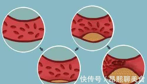 废弃物|公认的长寿特征，对照自查一下，若全占，寿命不会短