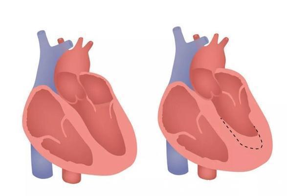 服用|最适合老年人服用的降压药是坎地沙坦，医生告诉你为什么