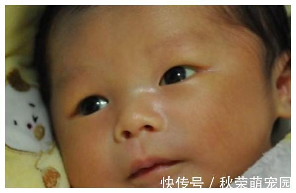 宝宝|儿科医生:想要宝宝出生没黄疸,孕期坚持“3不做”,别不当回事