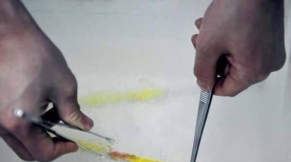 培养箱|揭秘试管婴儿全过程(附图),看完后心疼女性一万遍