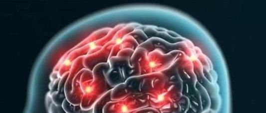 老年痴呆|老年痴呆程度测试一分钟找出七个字是正常，五个中期三个晚期