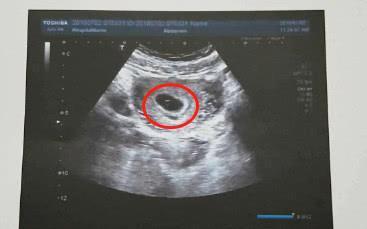 孕囊|孕期反应看男女?过来人说出“大实话”,告诉你什么才是最准确的