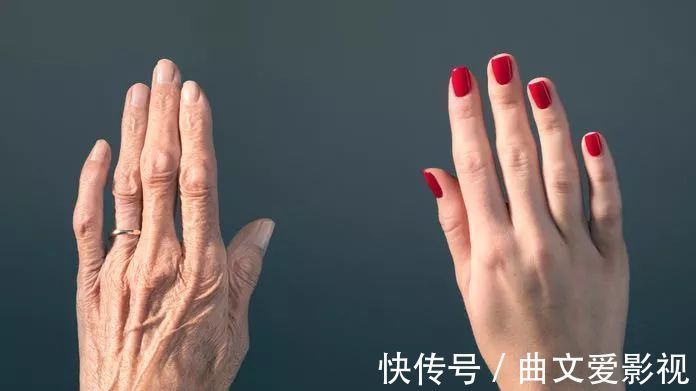 桑椹|气血虚容易老,1个食疗方比吃10斤阿胶帮助还大,还花钱少!