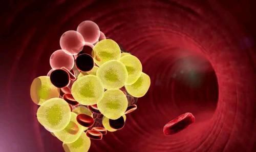 人体能自动消除血栓预防血栓的方法,主要有5种,看了心里踏实