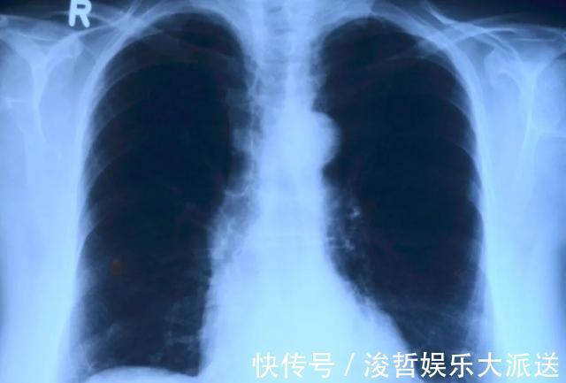 生气|这6种病都是气出来的！不生气才能少生病！一句话点醒无数人