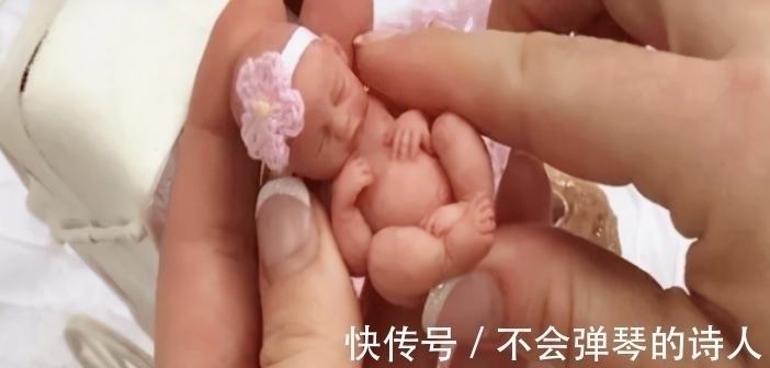 生命力|出生时仅25厘米的“拇指姑娘”，曾被断言活不过3月，却健康长大