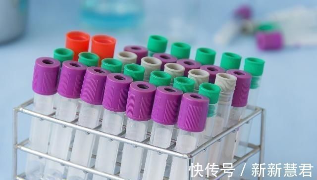 并发症|3种食物是“升糖王”,若患糖尿病不忌口,打胰岛素可能都没用