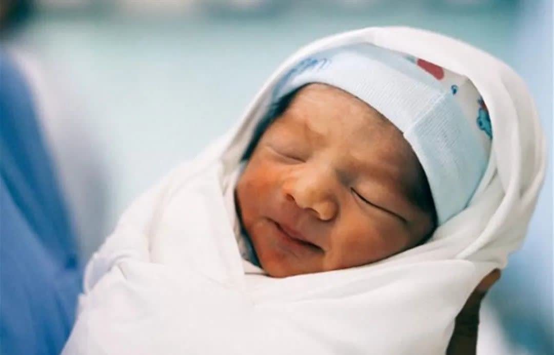 病理性黄疸|新生儿为什么会出现黄疸?该如何应对?关于黄疸你想知道的在这里