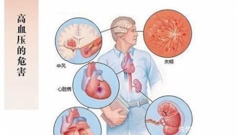服用|高血压是“中风”主要危险因素,预防中风,需要做好以下3点!