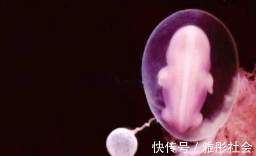 妈妈|孕妈什么时候“显怀”才正常?过早显怀,可能和这些原因有关系