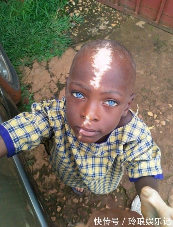 脚趾|19个“被上帝挑选过”的特殊基因人类,怎么梳都不整齐的头发