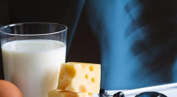 经常性|骨质疏松怎么办?先做到这3点,把骨头慢慢“养”好!老年人记牢