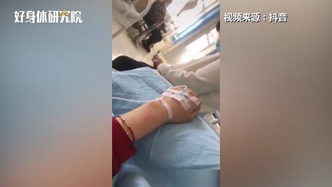 女子连拔3颗智齿肿成松鼠脸 专家称智齿若端正不用拔