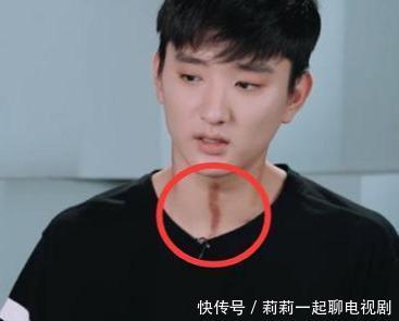 于小彤后台采访忘开滤镜 看到他脖子上皮肤后陈小纭不管管 快资讯 于小彤后台采访忘开滤镜 看到他脖子上皮肤后陈小纭不管管 快资讯