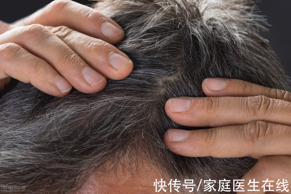 牛角梳|白发多的人不易患癌？假的！看完这些之后，你就知道怎么回事