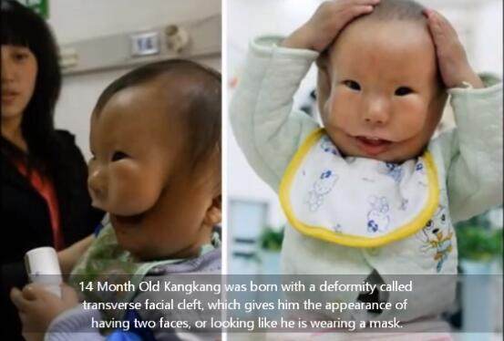 康康|宝宝安全出生,可妈妈看到宝宝的样子失声痛哭!