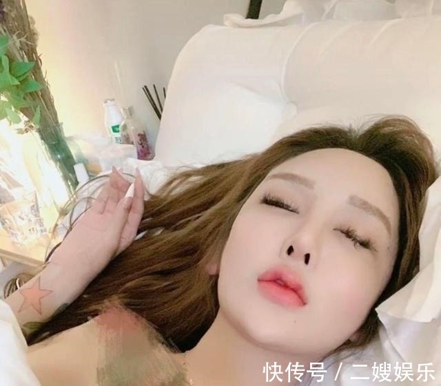 东北女孩 8年的整形手术花费了100多万,光额头就打了200多支玻尿酸