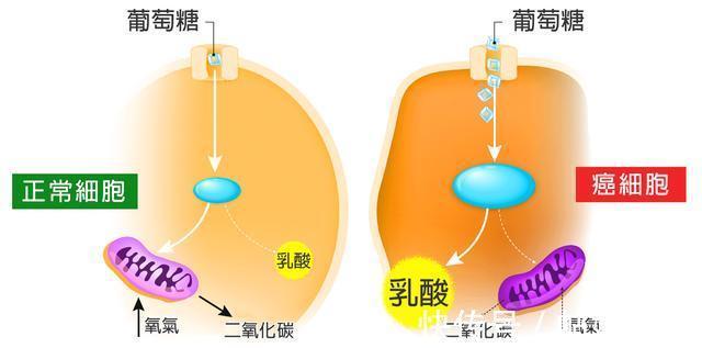 乳酸菌饮料|少吃这5种含糖食物，正常人吃过量的糖会促发癌症