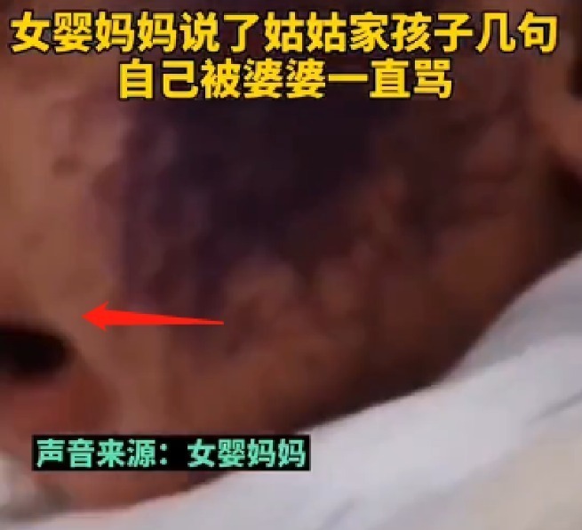 满月女婴遭亲戚孩子乱涂乱画,脸上全是墨水,亲戚:和孩子较啥劲