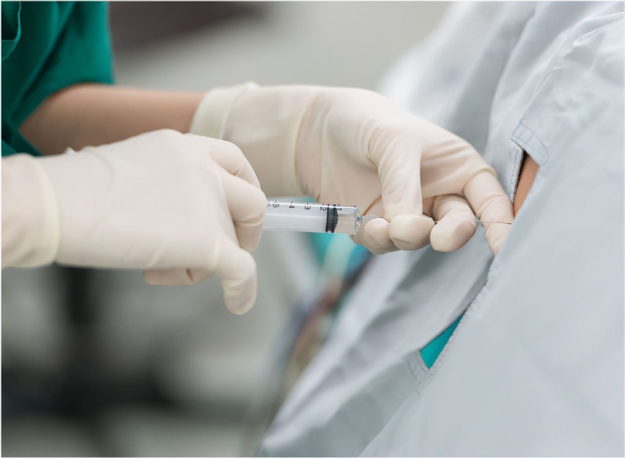 镇痛|一个哇哇大叫、一个刷手机,有时麻药也不是万能的,也得看心情