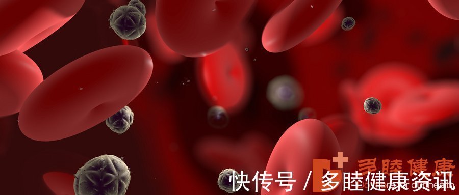 凈化|日本血液凈化-高血脂可能會引發的并發癥都有哪些？