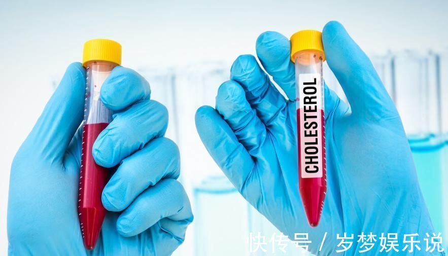 游离脂肪酸|甘油三酯过高怎么办坚持5件小事，清理血管垃圾、甘油三酯降了