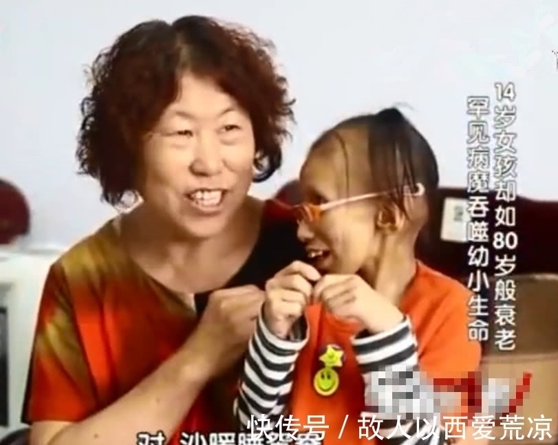 医生|14岁女孩像80岁老人,做完手术的1句话,让医生父母纷纷落泪