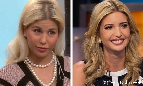 整容|女子花重金整容,一年经历13次整容手术,整容前后判若两人