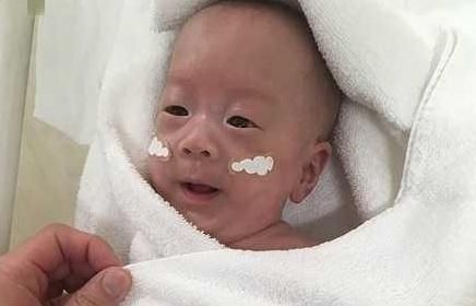 身体机能|母亲在怀孕期间长时间没有体重增加,婴儿只有268克,成为世界上最小的男孩