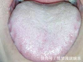 祛湿|早晚吃一物,排出体内多年湿气,健康又漂亮,神奇!