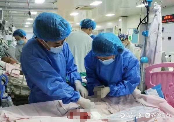 ecmo|女孩“暴心”，烟台医护上万次胸外按压、176小时ECMO急救