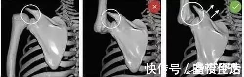 动作|练胸和练肩都需要“沉肩”,那么卧推的沉肩和肩推的沉肩方式一样吗?!