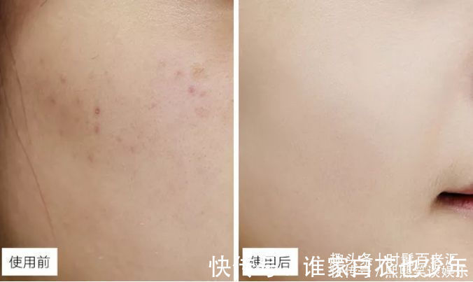 sod|别再瞧不起国货,这些国货护肤品,虽然包装“老土”,但真好用