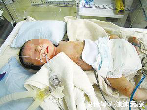 举动|十四个月大的宝宝吃完饭变成植物人,竟是妈妈的小举动造成的